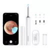Čistič uší Bebird T15 Smart Visual biely — vizuálny otoskop na čistenie uší