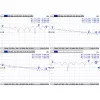 Kábel Mmcx to RPSMA/ACMMCXRPSMA Mikrotik