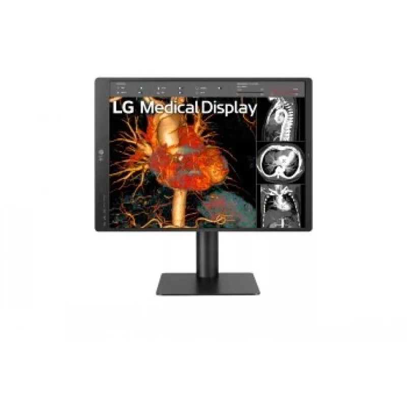 LG 21.3 palcov 3MP IPS diagnostický monitor 21HQ513D-M