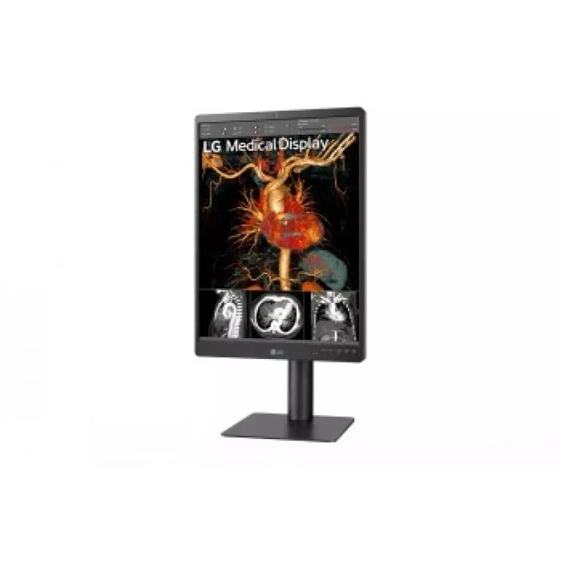 LG 21.3 palcov 3MP IPS diagnostický monitor 21HQ513D-M