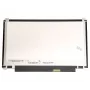 LG 11,6